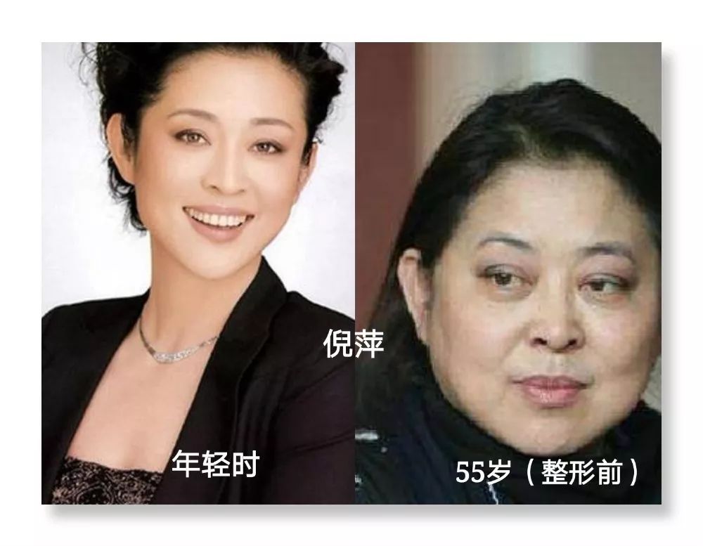 10位被整容毁掉的女明星,蛇精脸,面容扭曲,被毁掉的不止是美丽