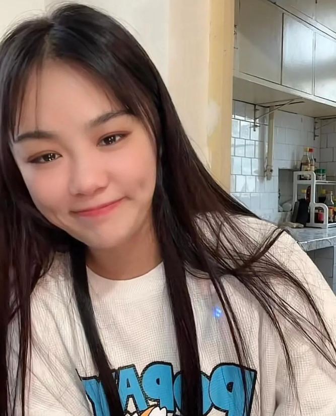 网红樊小慧整容前后变化大,眼皮红肿仍未恢复,直言不敢出门见人