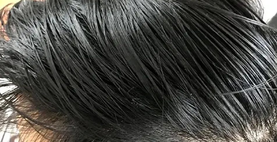 头发爱出油,是怎么回事?告诉你真正管用的做法