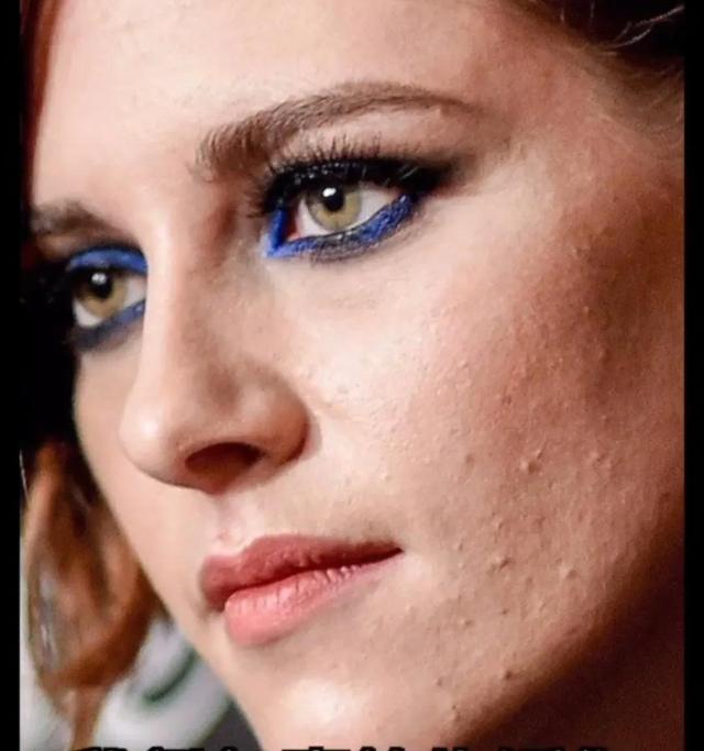 拒绝精修容貌焦虑:原来没了精修的明星皮肤竟也是如此多的缺陷