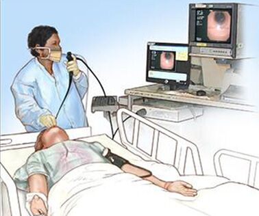 急进性肾小球肾炎,简称急进性肾炎,是肾小球肾炎中最严重的类型