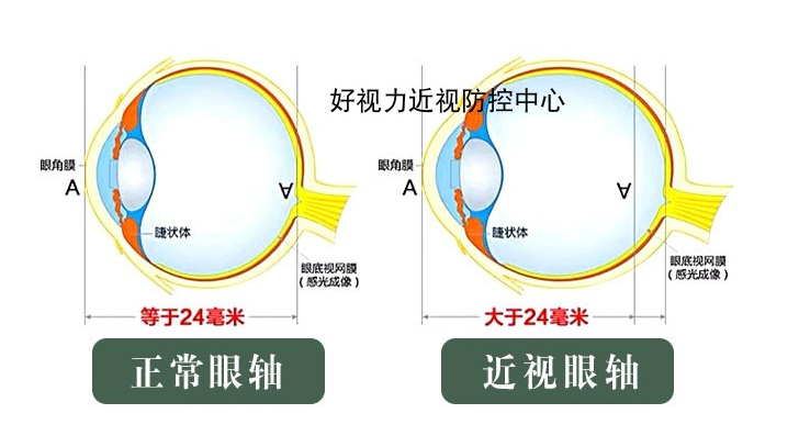 巩膜距图片