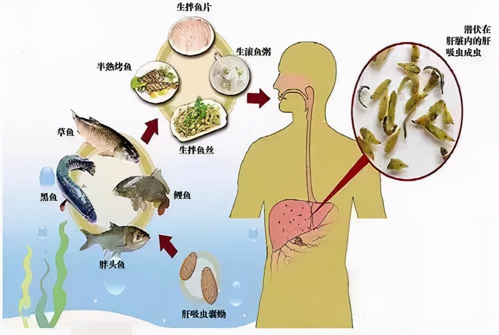 因為生吃蛇膽,28歲男子腦子被寄生蟲感染!這6類食物不要生吃