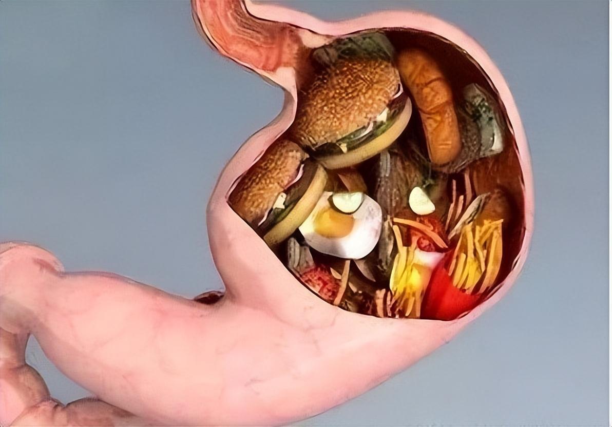 回顾10分钟吞24个汉堡!从名校教授到大胃王,李蕙为何会意外猝死