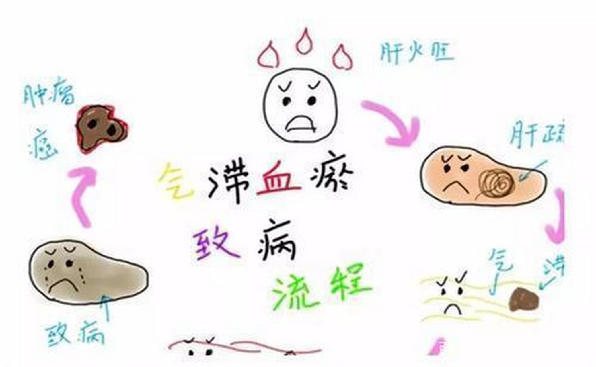 肝郁的4个进程,你到了哪一步?   大家好,我是中医刘家福.