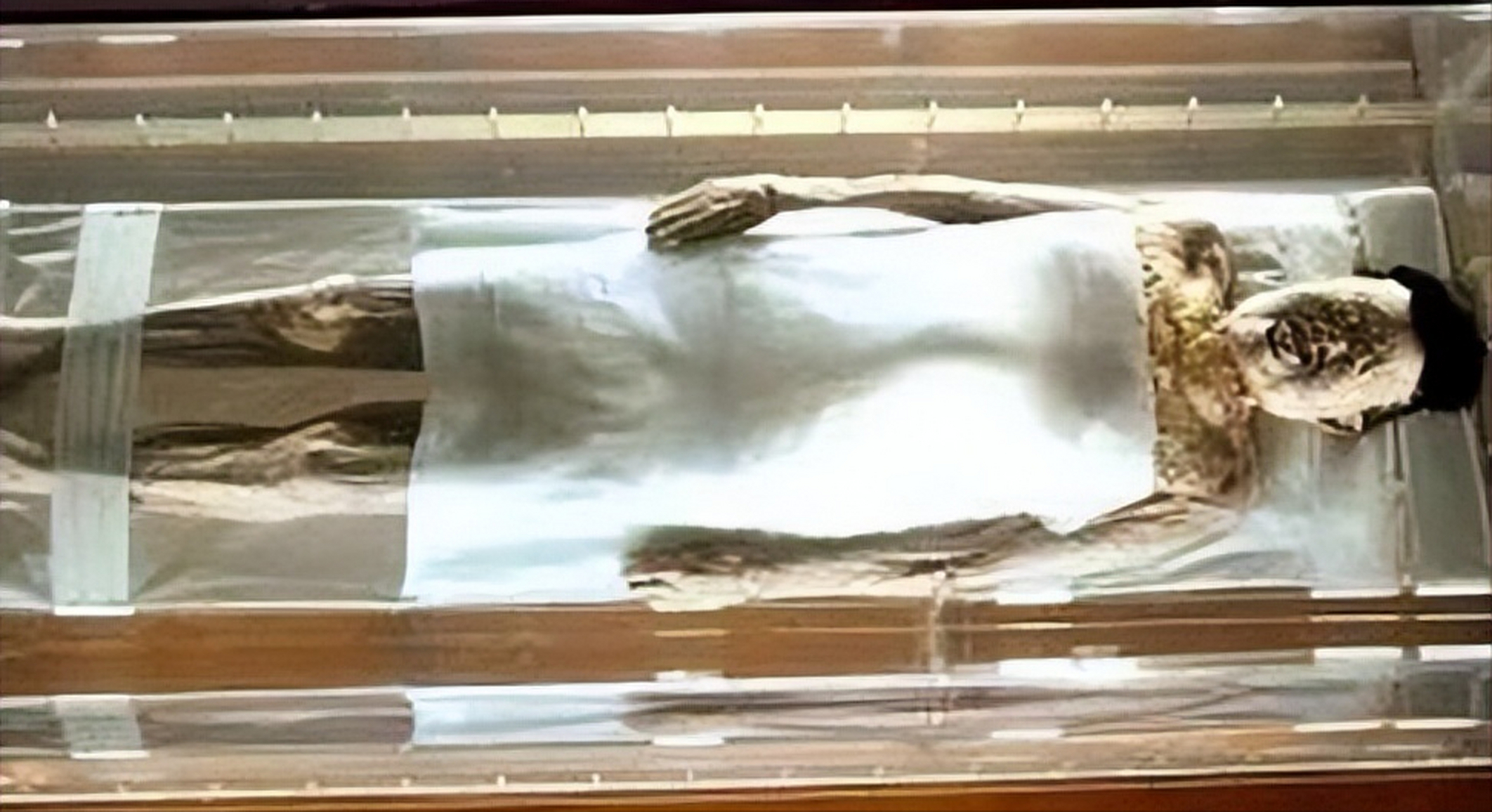 "辛追夫人"不论是肌肉组织还是软骨组织,都呈现着一种保存完好的态势.