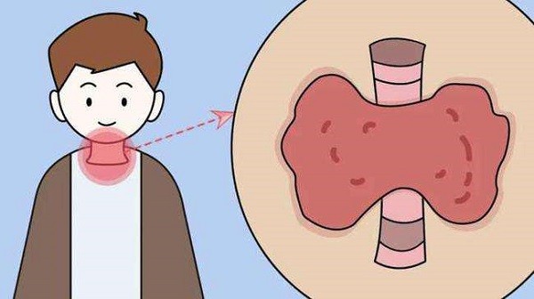 福州博医汇国医馆中医陈乃杰带你走出甲状腺误区