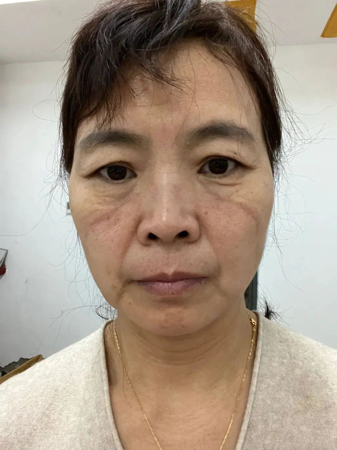 付长凤尽职尽责做隔离群众健康的守护人