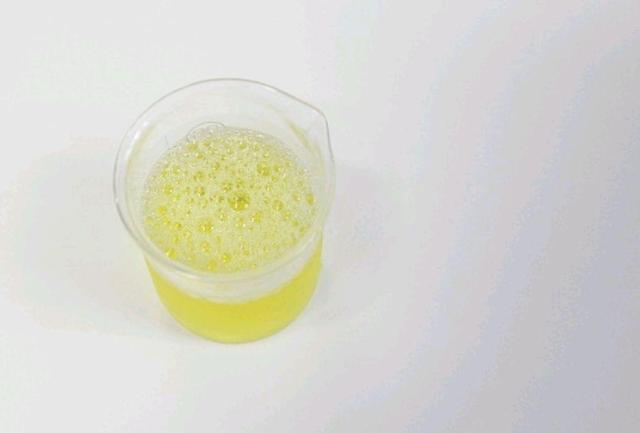 排尿时,尿液出现泡沫,就是肾不好的表现吗?内科医生为您详解