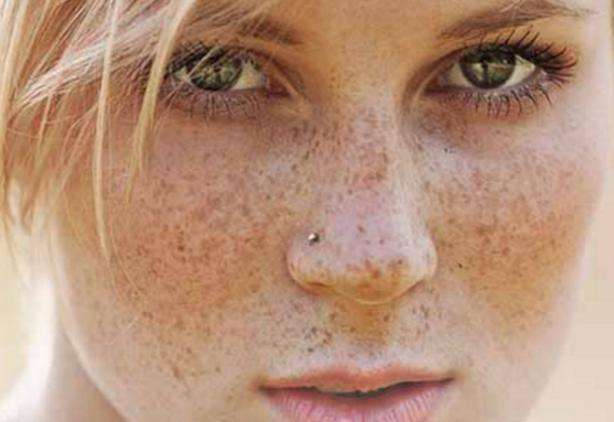 女性常吃白菜会加重面部斑点?医生:不想满脸斑,4种要少吃