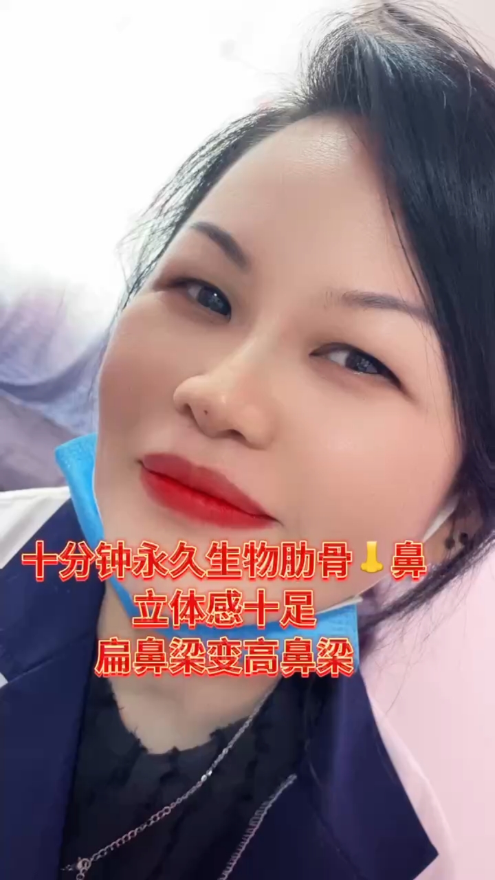 十分钟永久生物肋骨鼻,立体感十足,扁鼻梁秒变高鼻梁