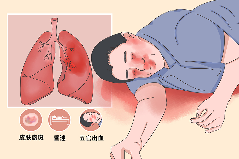 创伤性窒息,往往是由于患者受到暴力而引发的疾病,情况较危急