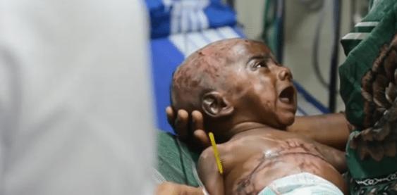 印度男婴降生自带火种,3月内就自燃4次,人称"火神转世"!