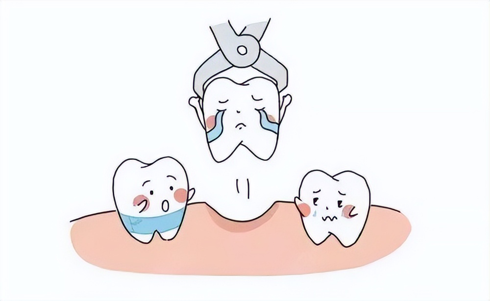 牙友:門牙前突戴牙套一定要拔牙?矯正牙齒要拔牙有什麼危害嗎?