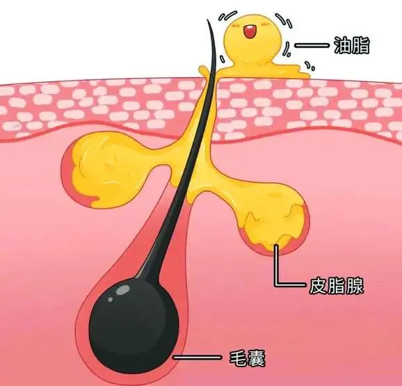 头发出油严重怎么办?