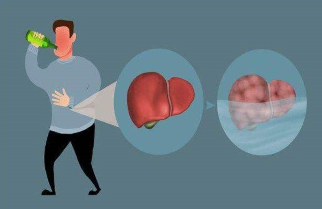 乳疬,发生于男女儿童或中老年男性的乳房异常发育性疾病,不遗传