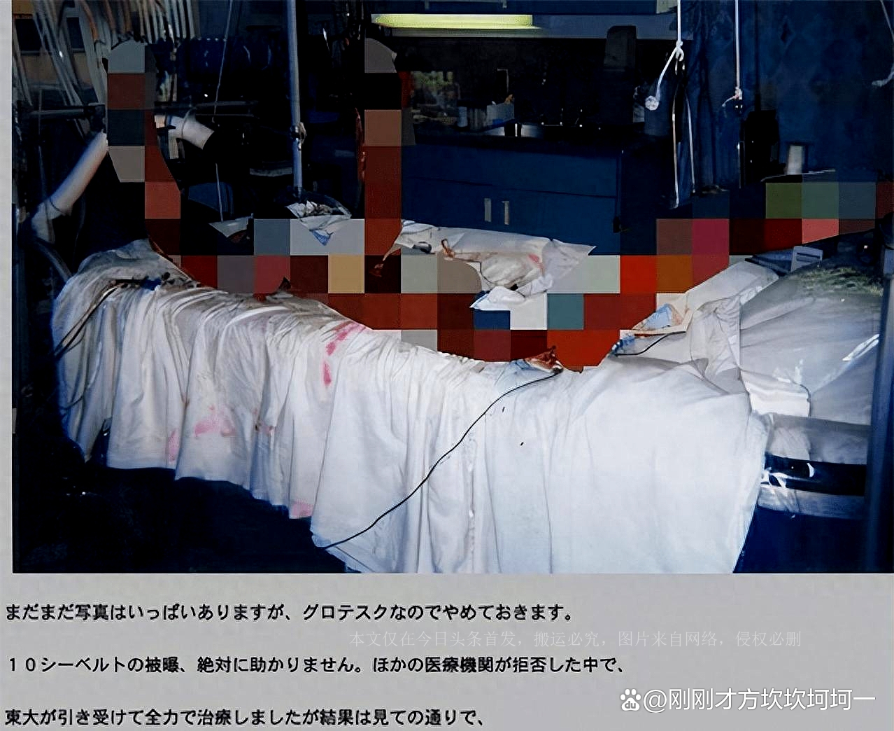 核辐射死亡真实事件