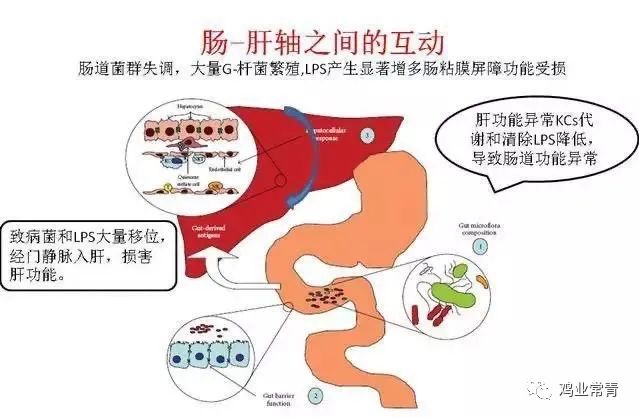 武思远:肝肠轴,一个容易被忽视的紧密关系(值得收藏)