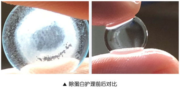 美尼康护理液,角膜塑形镜的除蛋白"利器"