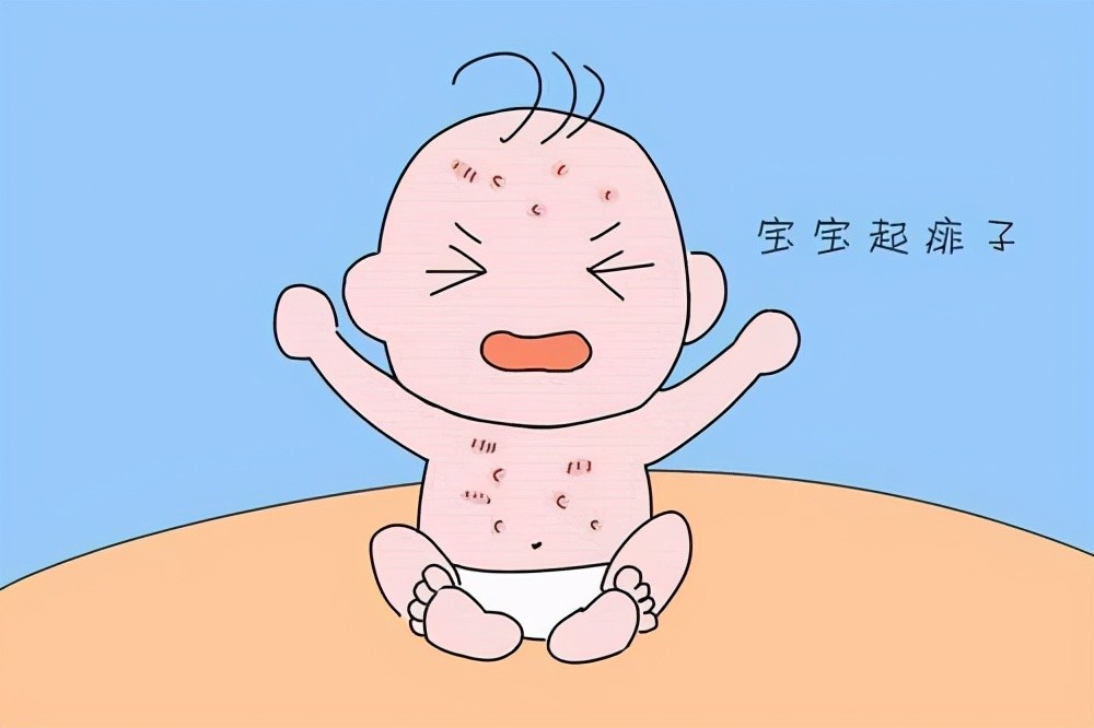 夏季宝宝红屁屁,淹脖子,起痱子,这样预防与处理效果好又省钱