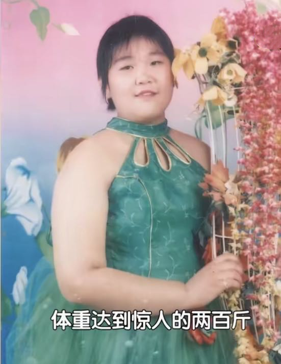 280斤特型女演员:因为胖打开事业之门,如今却切胃保命,图什么