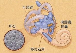 耳朵中的"小石头"总是捣乱?无需担心,治疗很简单!