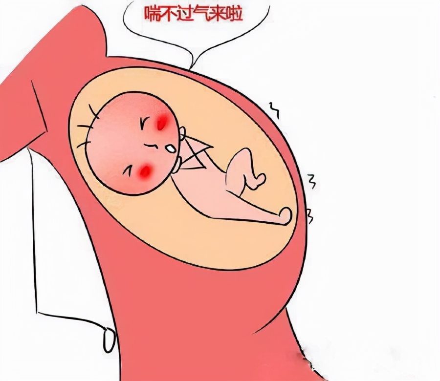 孕妇胆汁淤积图片大全图片