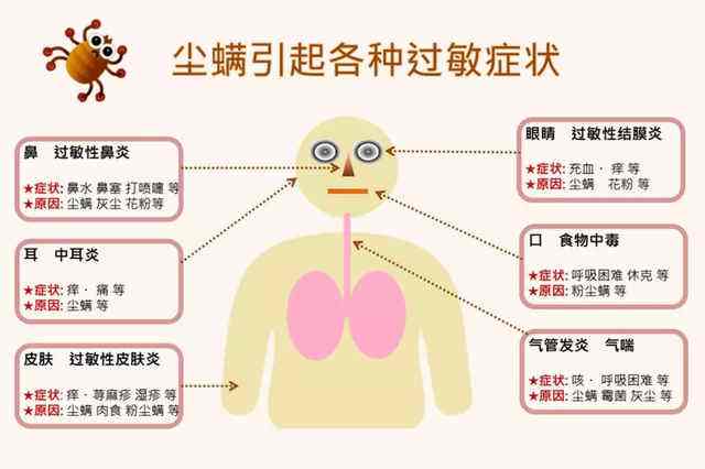 床上的螨虫已成堆教你笨招屋里放它让螨虫全跑光光
