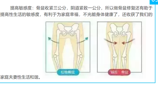 動輒上萬的產後骨盆修復:一場放大女性焦慮的