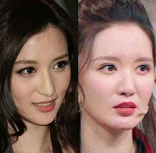 40岁张萌近照曝光,脖子比例失调尖下巴抢镜,被质疑整容