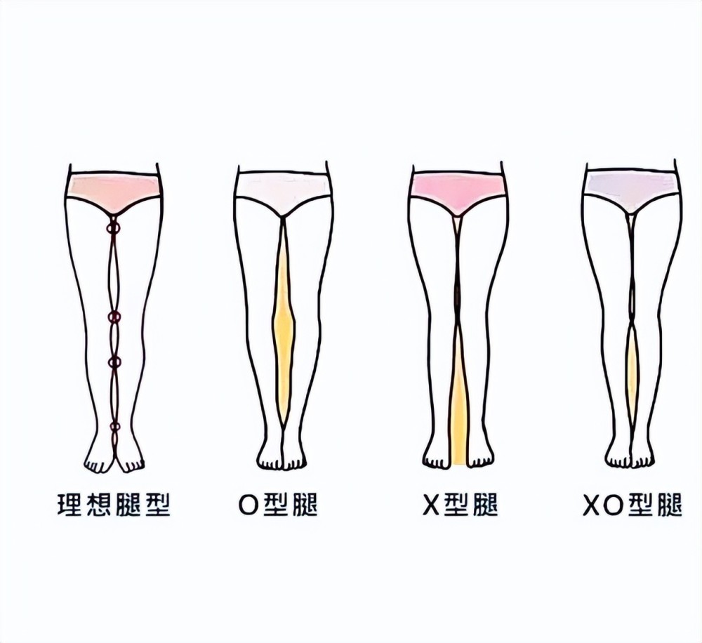 体育纳入高考!别让扁平足影响到孩子体育成绩