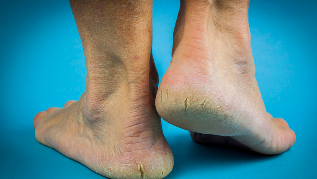 海中断脚:14年间,21只人足频现海岸,专家:不同寻常也并非少见