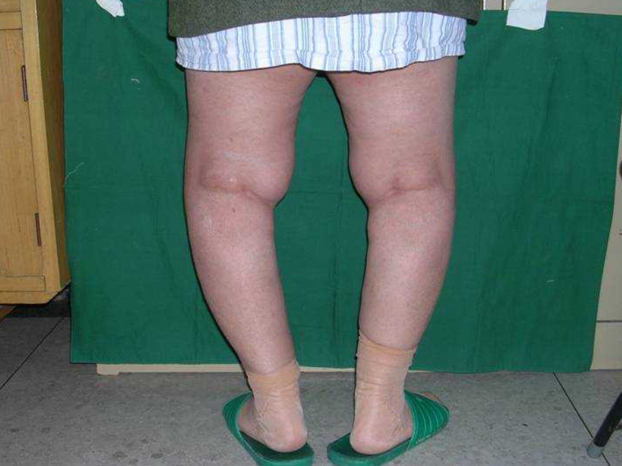 别给新生儿穿两种衣服,会影响宝宝腿型发育,长大腿型差会怪你