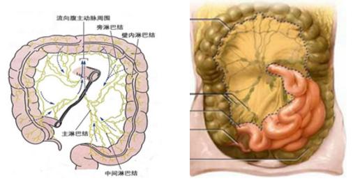 儿科医生带你了解急性肠系膜淋巴结炎