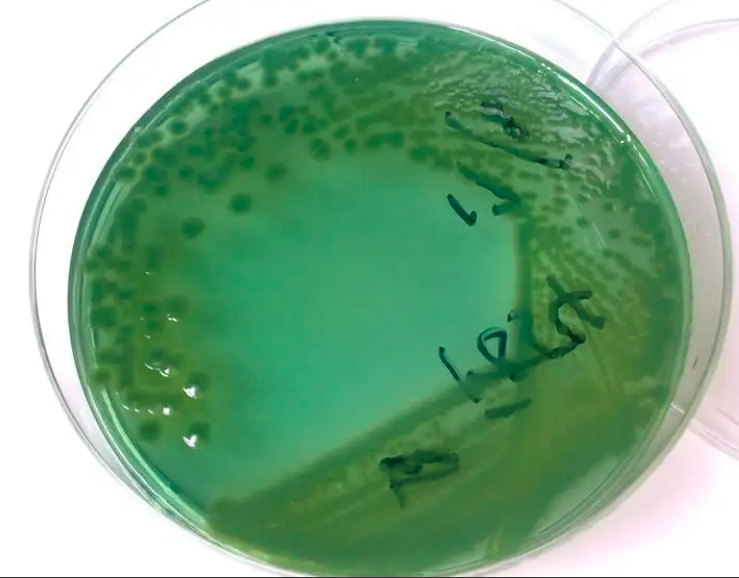 為啥對蝦養殖會滋生弧菌?水智科生物分析弧菌爆發和哪些因素有關