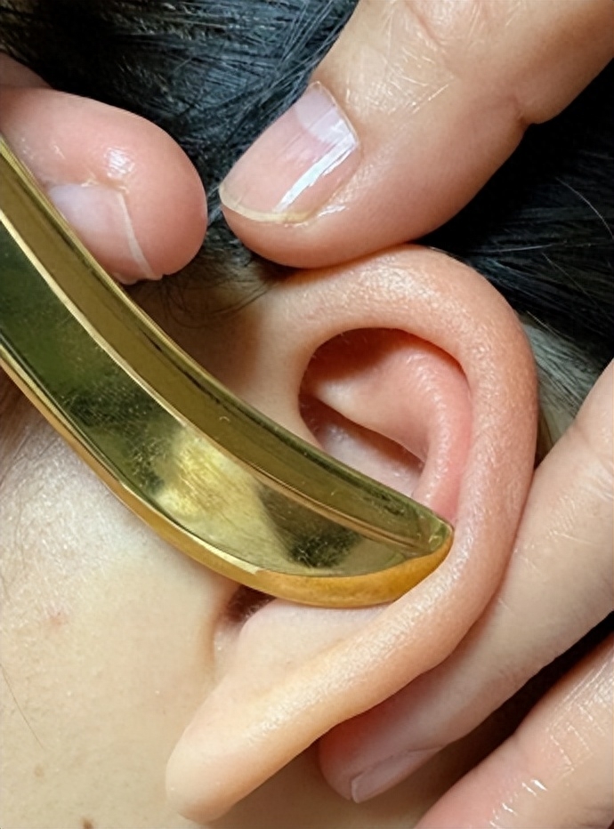 小耳朵内藏乾坤!耳部刮痧知多少?