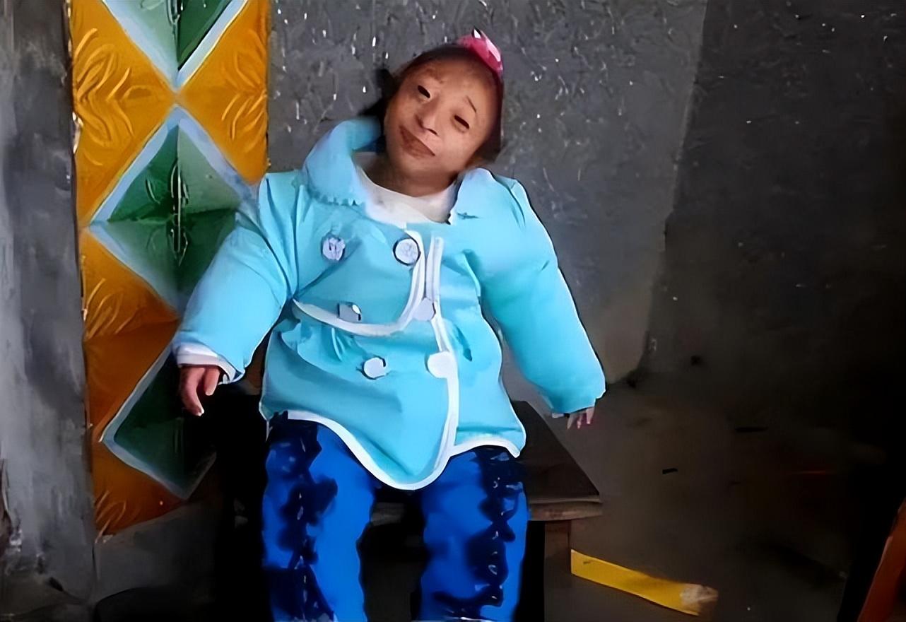 回顾湖南女子生下猴孩杂技团想重金买走母亲不可能