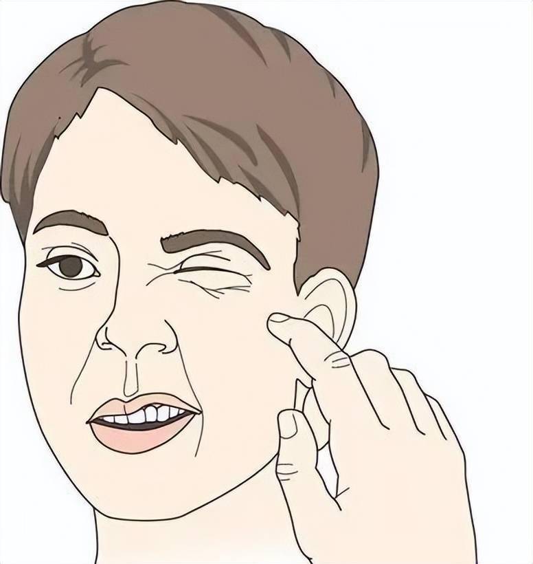 面部肌肉麻痹,表情僵硬,被风吹歪脸了?用三味药或可改善一二