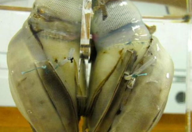 科学家发现5万年前的人造心脏,这难道是史前文明的产物?