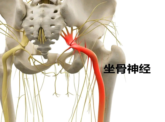 坐骨神经根图图片