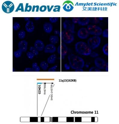 abnova 基因 fish 探针丨ccnd1(橙色)fish 探针