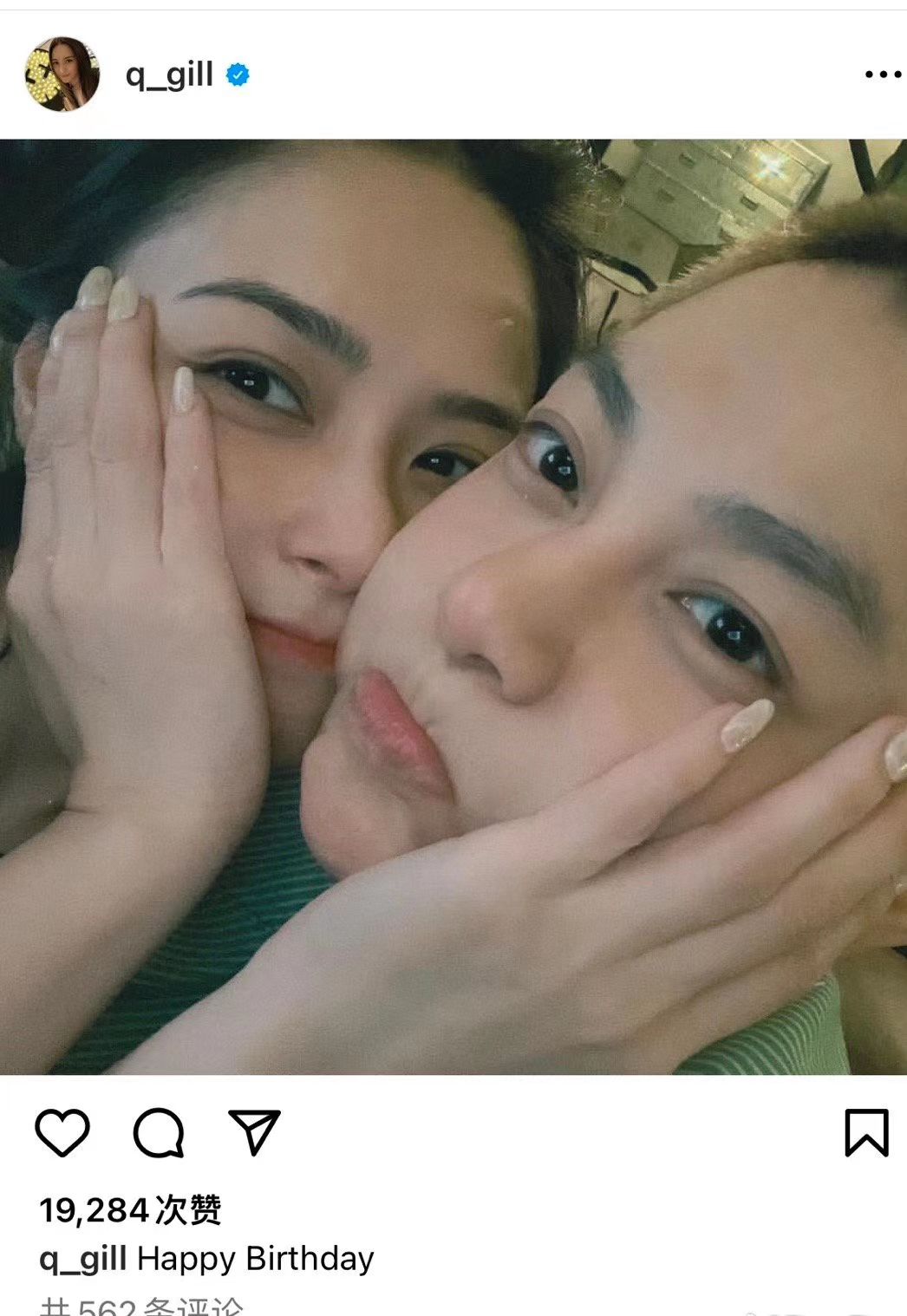 阿娇与皇甫圣华贴脸照曝光:是友谊还是爱情的甜蜜宣言?