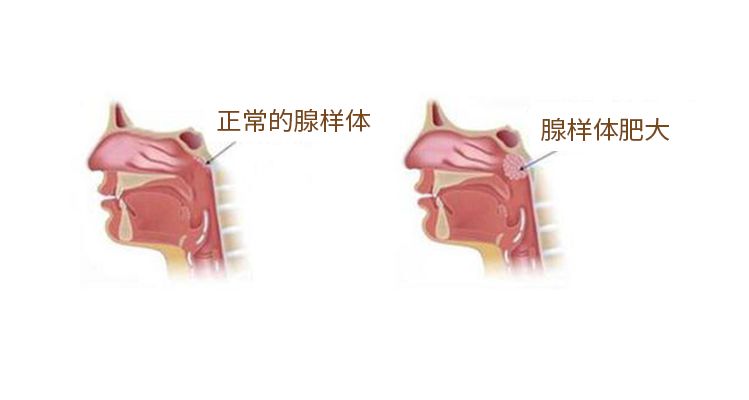 鼻窦位置图片图片