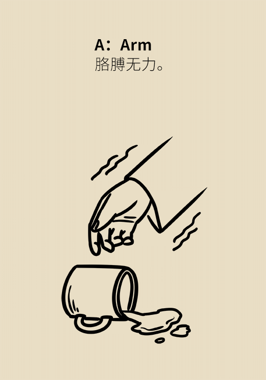 脑卒中发病逐渐年轻化哪类人群更容易发病