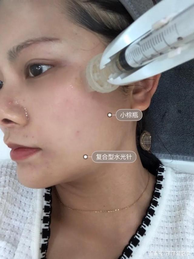 进来一起了解水光项目吧