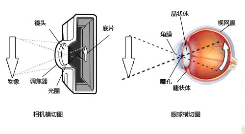 贵州晶朗眼科医院:白内障=玻璃上的雾气,擦掉就好了!