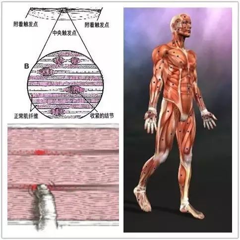 治疗疼痛有妙招