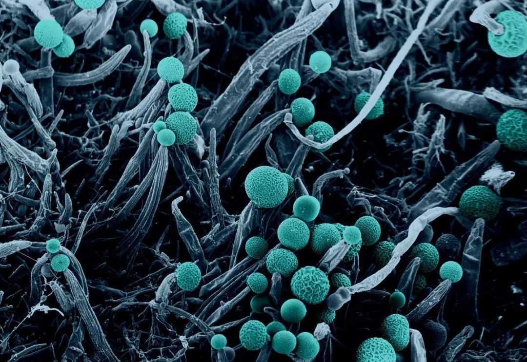 真菌中毒症,由肉毒杆菌毒素引起的急慢性毒性疾病,不会遗传