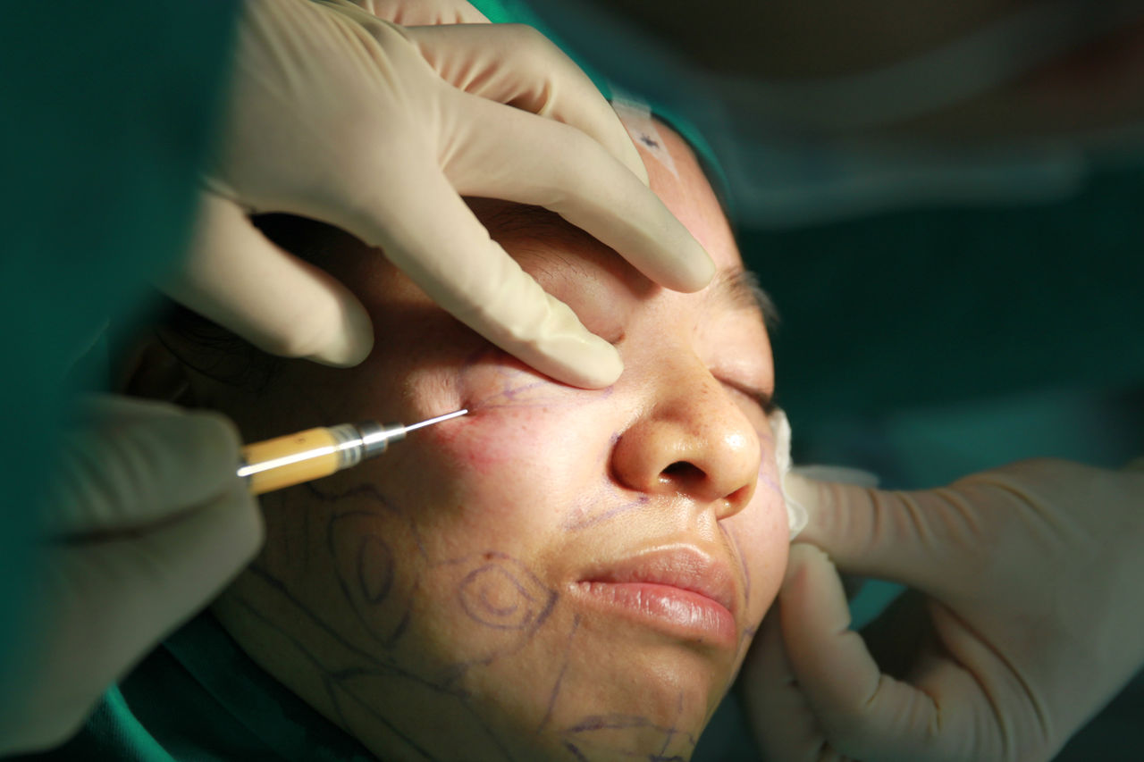 对自己脸部轮廓不满意?结合实际情况,采用脸部抽脂术去塑形减脂