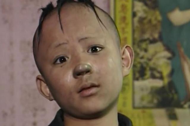 8岁出演《三毛流浪记》,后因秃顶植发时挨300多刀,今现状如何?